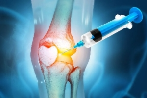 dr xin wang knee injection pain relief bellaire nexs medical