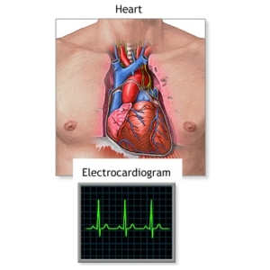 electro cardiogram service houston nexs medical irregular heartbeat chest pain